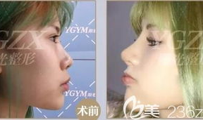 鼻子整形医生,技艺精湛，重塑美丽人生