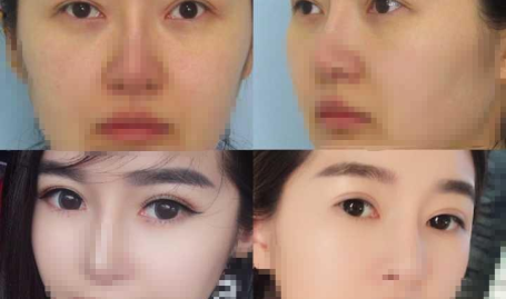 厦门整形,美丽蜕变，专业品质引领潮流